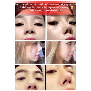 [Hot] Sụn nâng mũi 3D Hàn Quốc HIGH STEALTH