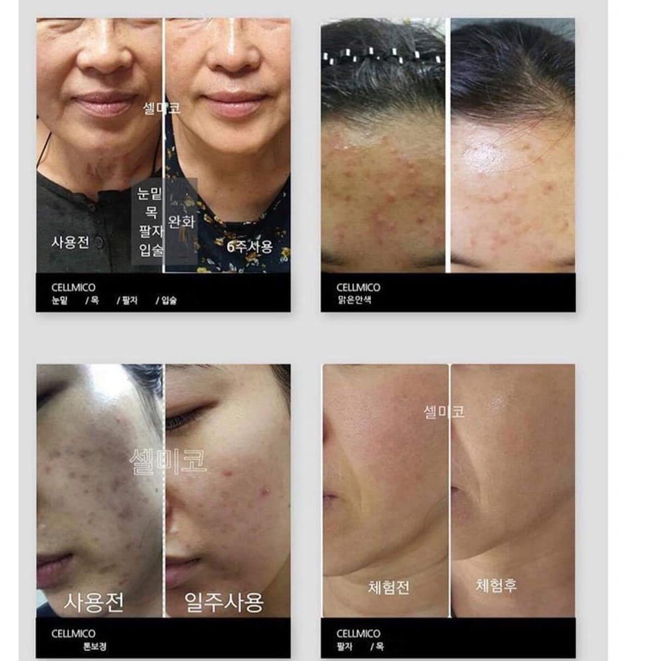 1 ống tế bào gốc CellMico dưỡng da chắc khỏe, căng mịn hỗ trợ điều trị mụn, đầy sẹo | BigBuy360 - bigbuy360.vn