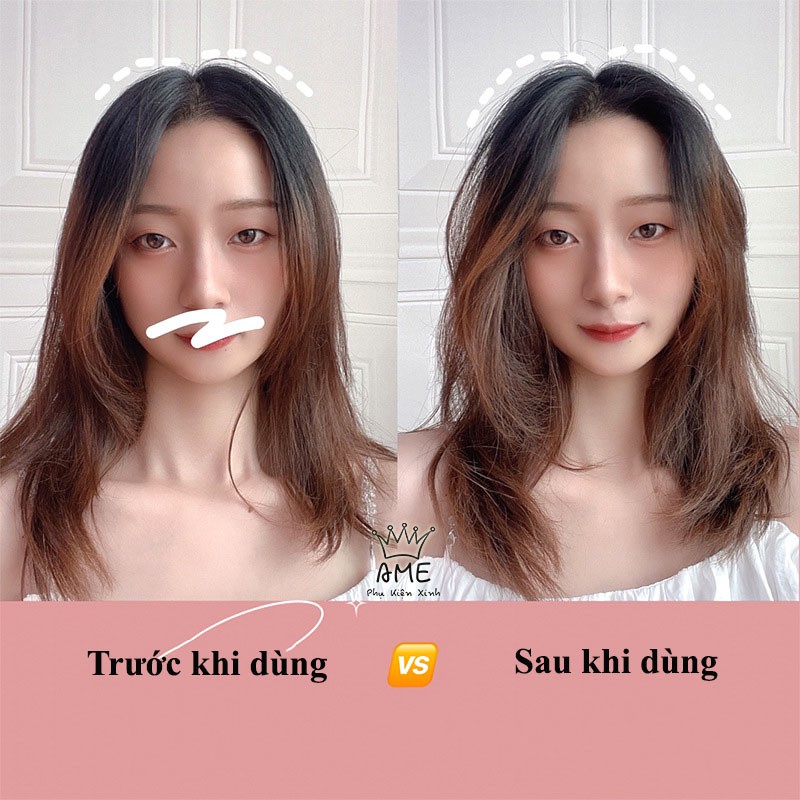 Kẹp phồng chân tóc mái , tạo nếp cong tự dính, Lô tóc mái, Lô uốn mái thưa hot Hàn Quốc