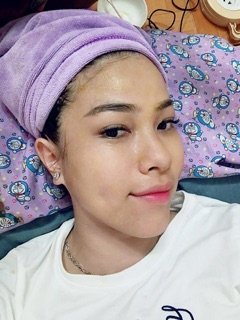 Cấy hồng sâm baby Hàn Quốc
