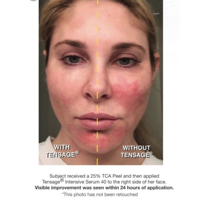 Huyết thanh chuyên sâu serum Growth Factor Biopelle Tensage Intensive Serum 40