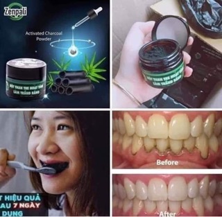 BỘT THAN LÀM TRẮNG RĂNG ZENPALI