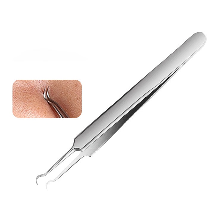 Bộ 3 Que Nặn Mụn hickies lacing system - Làm Sạch mụn Đầu Đen, Trứng Cá, Cám (Full hộp)
