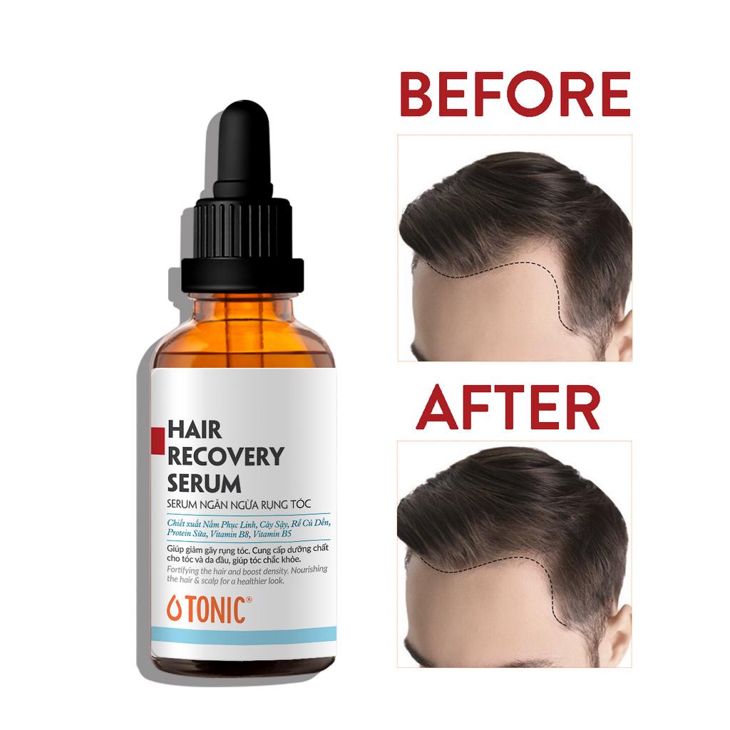 Serum dưỡng tóc,da đầu ngăn ngừa rụng tóc Lá House Serum Hair Therapy 50ml