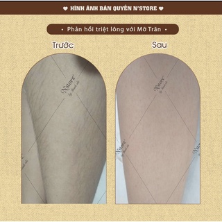 Mỡ Trăn Nguyên Chất Triệt Lông
