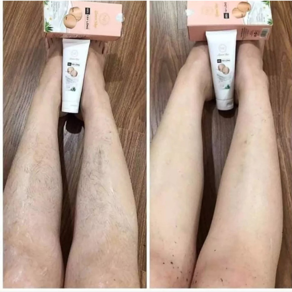 Gel tẩy lông dưỡng trắng không đau không rát triet long Mamen Shop[Hàng chính hãng]