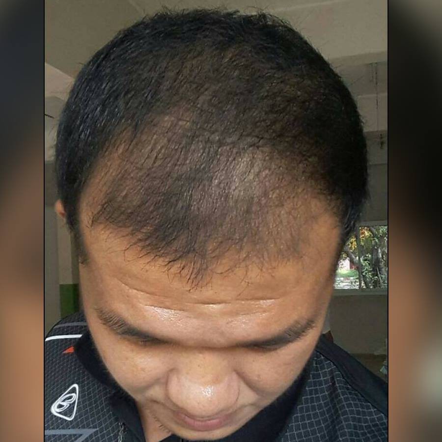 Đinh Hương Nhu xịt mọc tóc | BigBuy360 - bigbuy360.vn