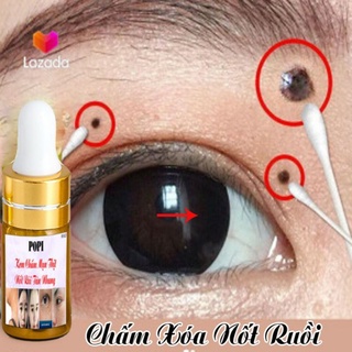Kem xóa nốt ruồi, tàn nhang,mụn thịt, mụn cóc,mắc cá popi