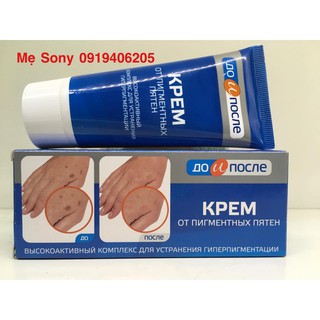Kem giảm đồi mồi tay
