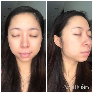 Sữa rửa mặt Surface radiance Medik8