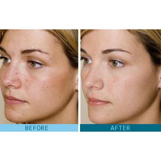 Serum The Ordinary Lactic Acid 5% + HA