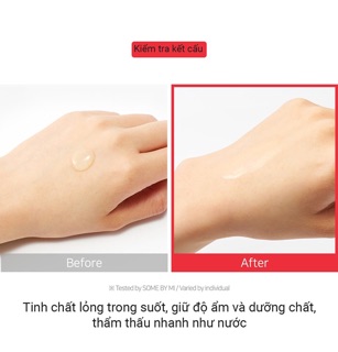 Serum ốc sên som by mi Hàn quốc
