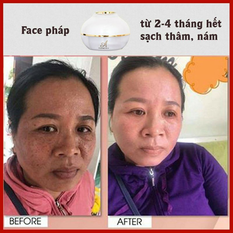Kem face phuong anh kam kết chinh hang so luong 9x ib | BigBuy360 - bigbuy360.vn