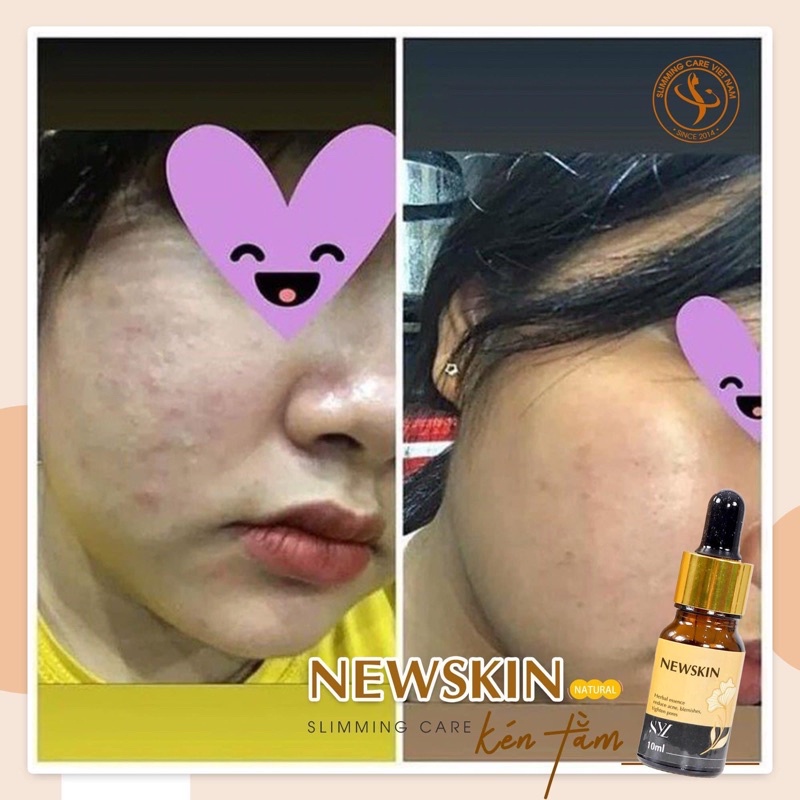 Tinh chất Newskin Sylic tái tạo da, trắng da và mịn da (10ml)