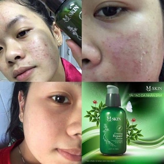 Tái tạo da nhân sâm