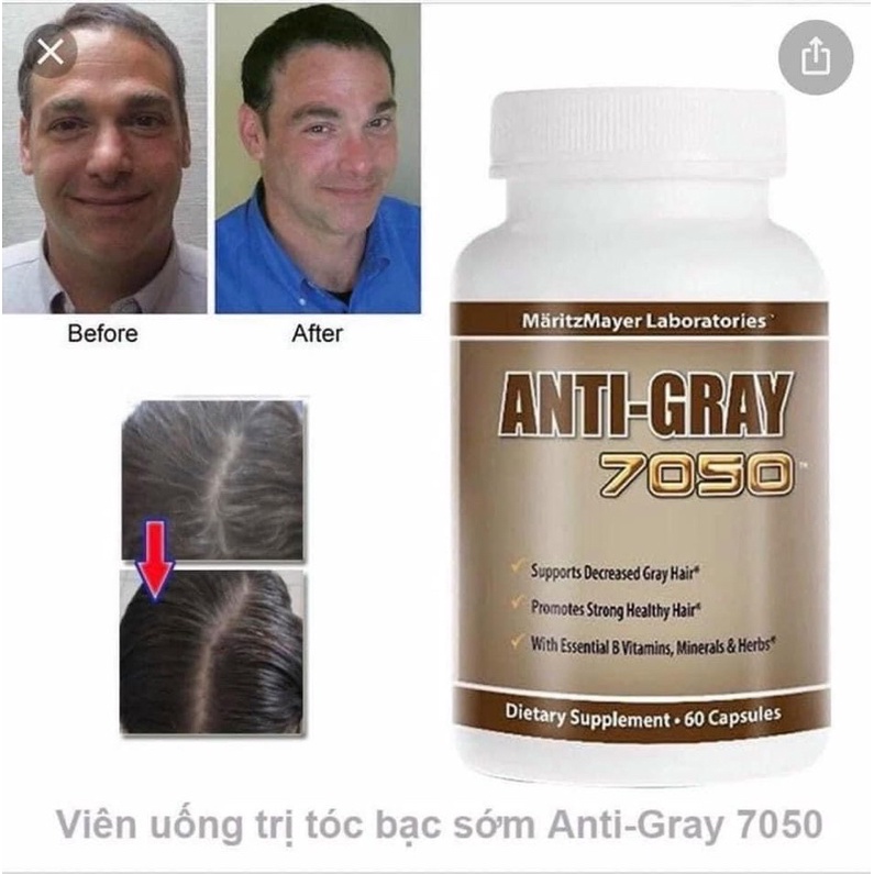 Viên Uống ANTI-GRAY 7050 hỗ trợ bạc tóc 60 viên - Hàng Mỹ