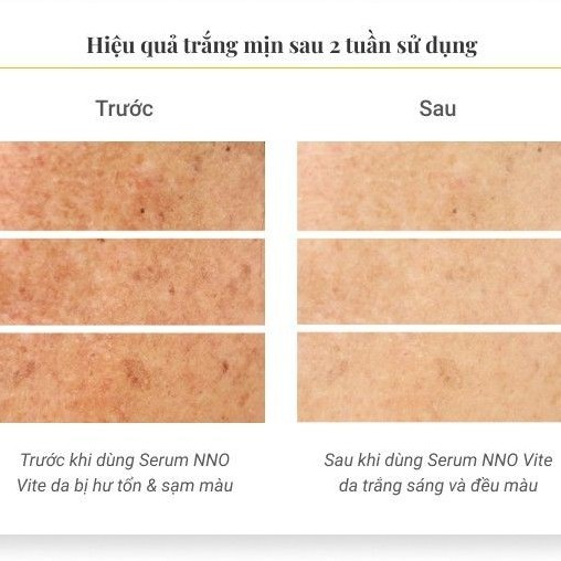 NNO - Dầu Dưỡng Da Ban Đêm NNO Nourishing Oil