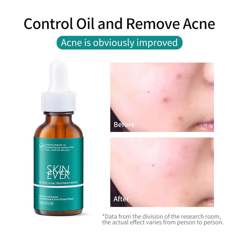 Beauty Shop Serum SKIN EVER chiết xuất cây trà/ nho biển giữ ẩm/ rau má/ cà phê loại bỏ quầng thâm 30ml