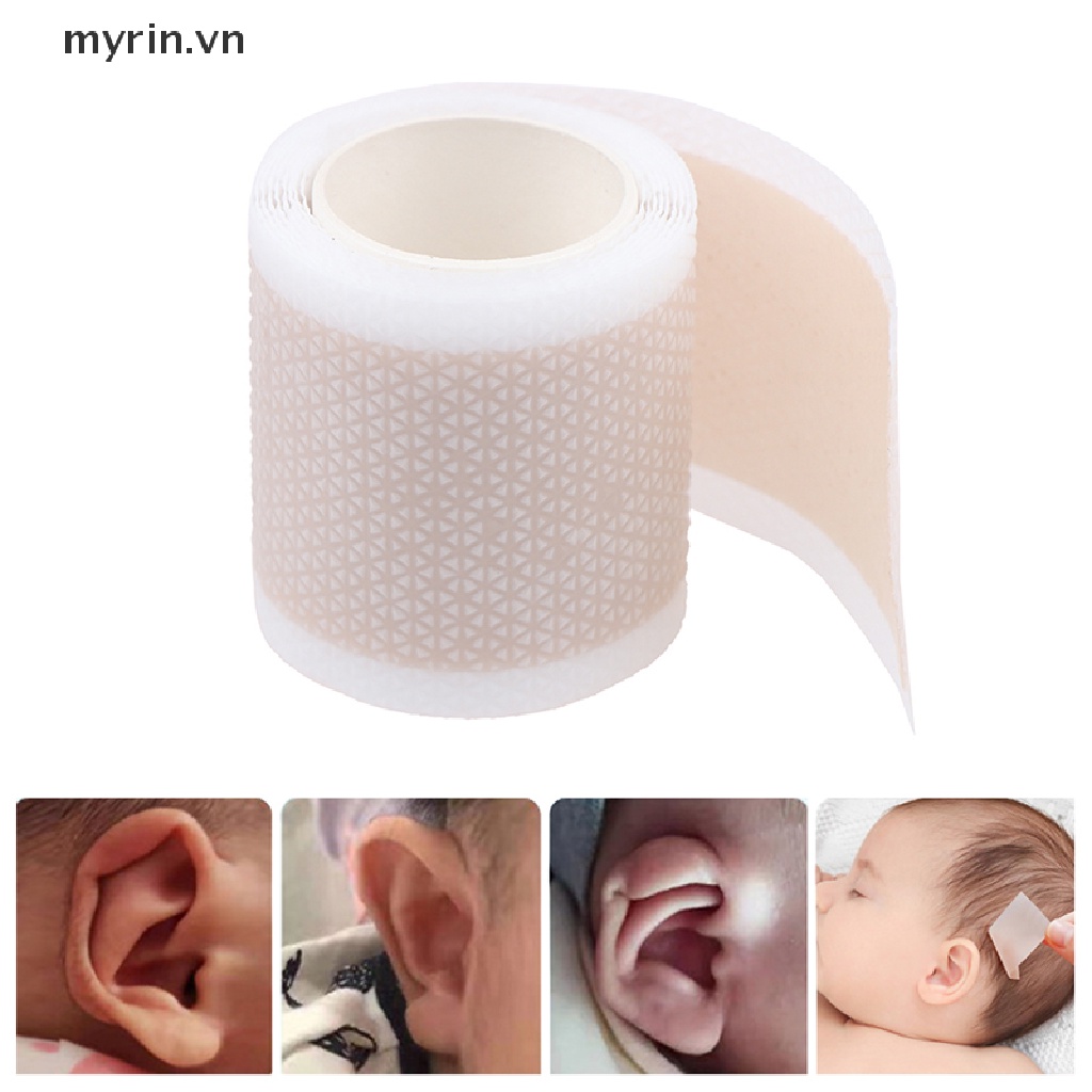 Miếng Dán Điều Chỉnh Tư Thế Tai Cho Bé Sơ Sinh 4 * 50cm