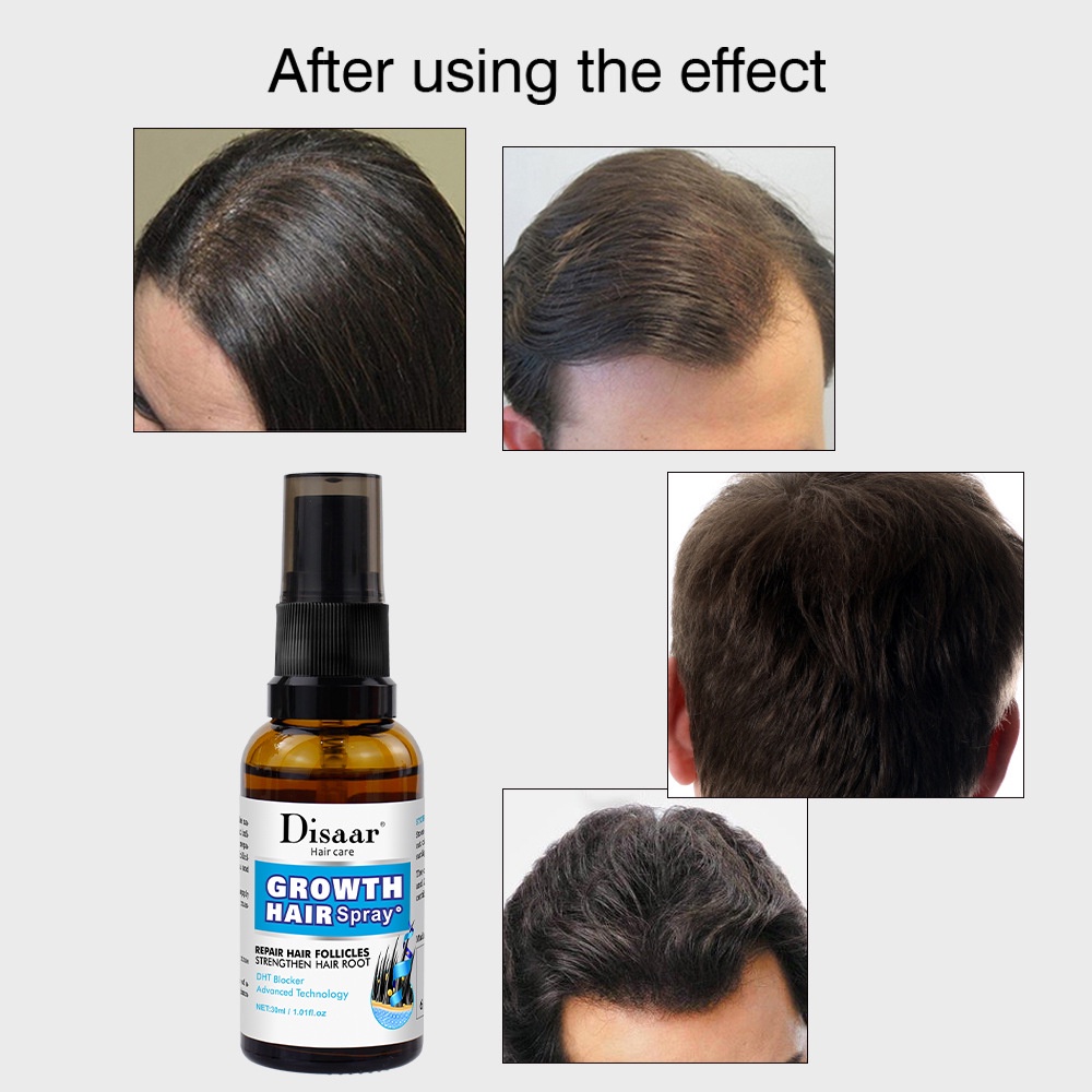 Tinh chất kích thích mọc tóc thảo dược Disaar Growth Hair Spray 30ml