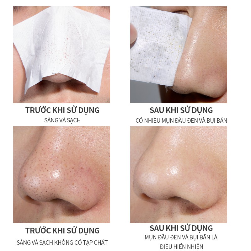 Bộ Sản Phẩm Tẩy Mụn Đầu Đen BAIMISS 180g Làm Sạch Và Se Lỗ Chân Lông | BigBuy360 - bigbuy360.vn