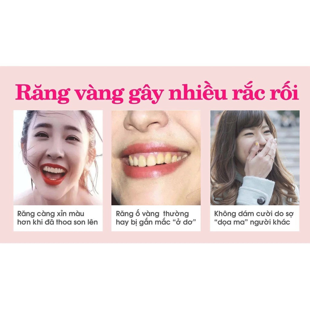 Miếng dán trắng răng IVISMILE - Dán trắng răng an toàn, hiệu quả cho người sử dụng, không gây ê buốt hay bào mòn răng