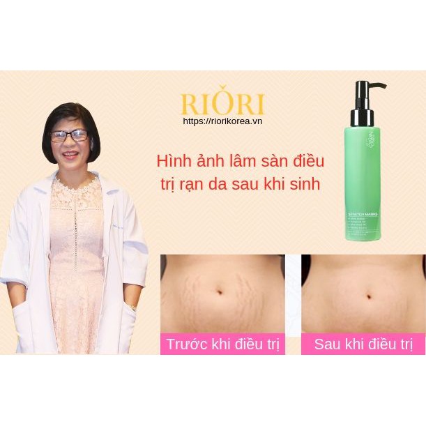 Kem rạn da Riori Stretch Marks | BigBuy360 - bigbuy360.vn