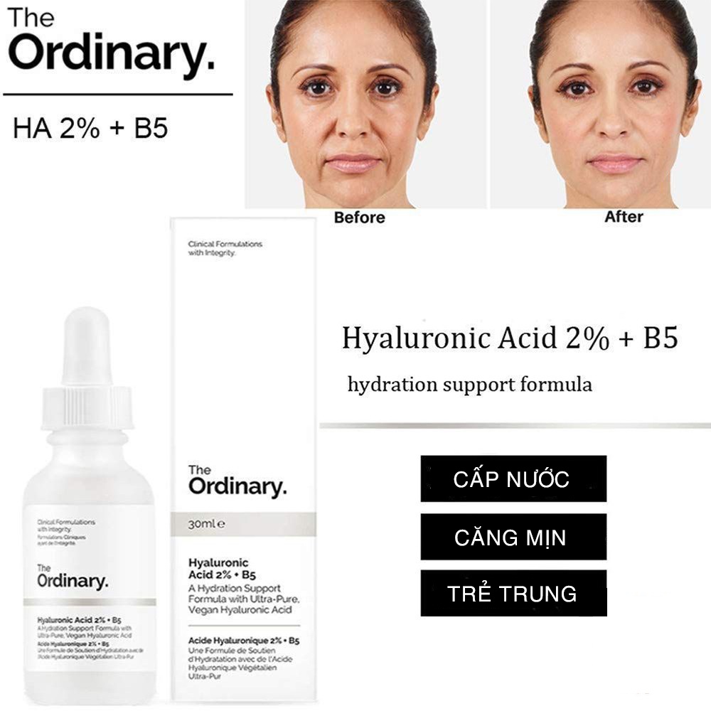 Serum The Ordinary Hyaluronic Acid 2% + B5 cấp ẩm phục hồi da 30ml - 60ml