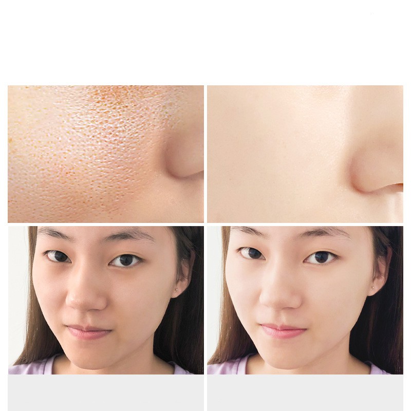 Xà Phòng Muối Biển Cho Mụn Lưng Sea Salt Soap | BigBuy360 - bigbuy360.vn