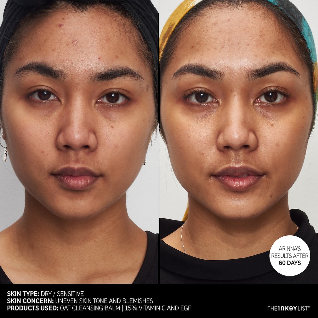 Serum THE INKEY LIST 15% Vitamin C and EGF Brightening Serum