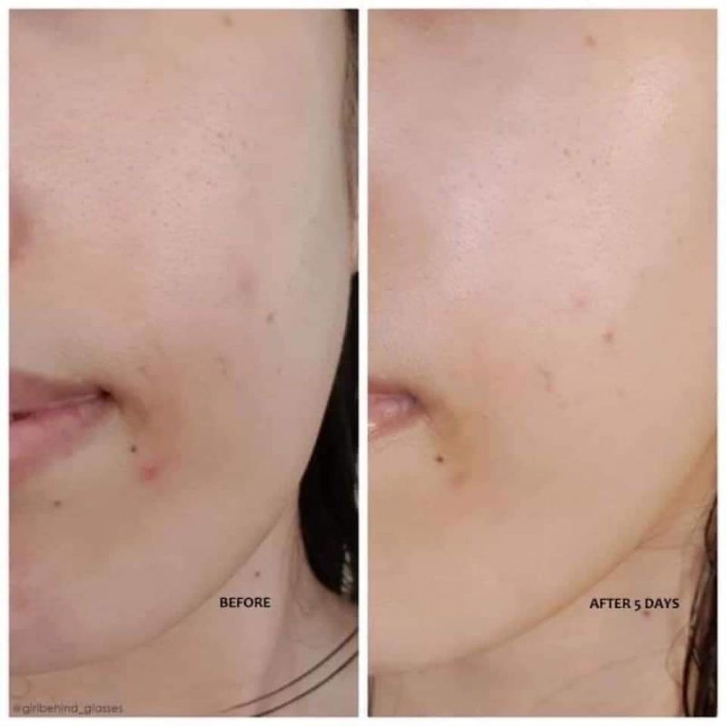 Serum Nia 20% Derma Factory
