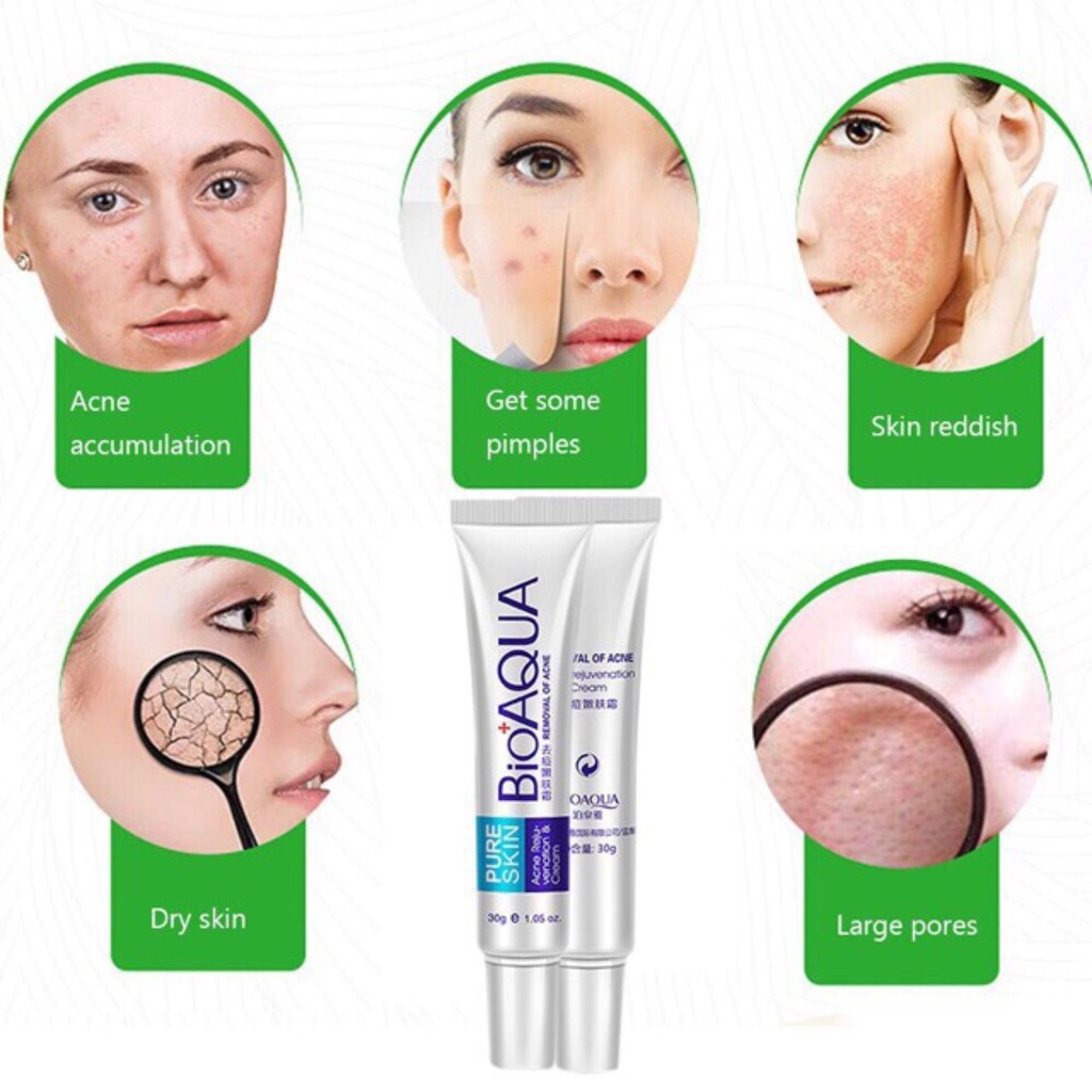 Kem lành mụn Bioaqua Pure Skin Hàng Nội Địa Trung - BUMSHOP79 | BigBuy360 - bigbuy360.vn