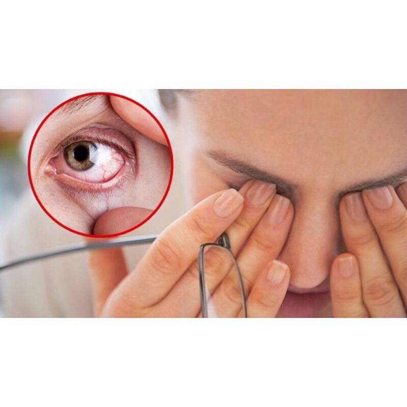 Gel tra mắt liposic eye gel 10g (hỗ trợ giảm khô mắt) (made in đức)