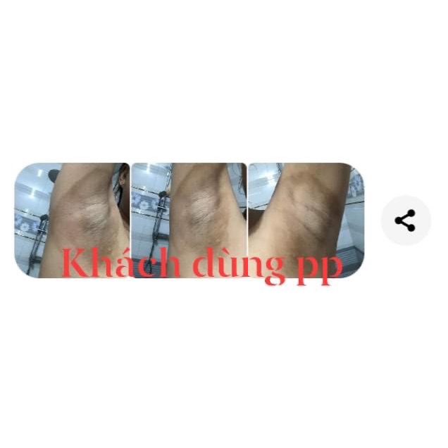 VI THẢO DƯỢC tái tạo sau 3-5 ngày loại bỏ Mụn, Nám, lỗ chân lông to