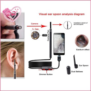 Camera nội soi ráy tai đa năng
