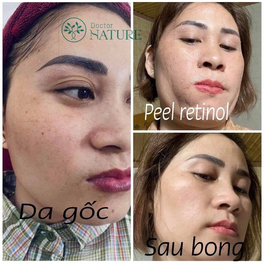 PEEL SKIN DOCTOR NATURE
