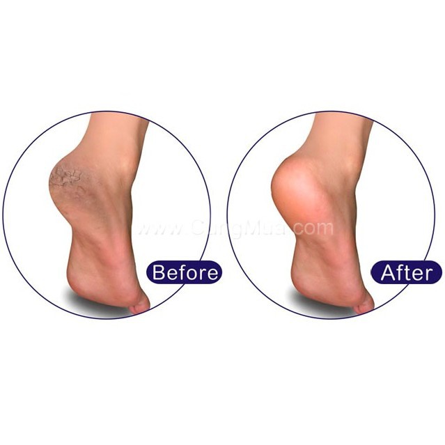 Cọ Chà Gót Chân Vacosi Hàn Quốc Foot Peeling Các Loại