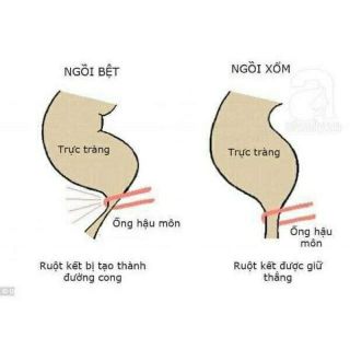 Ghế kê chân toilet cho vệ sinh ngồi thoải mái