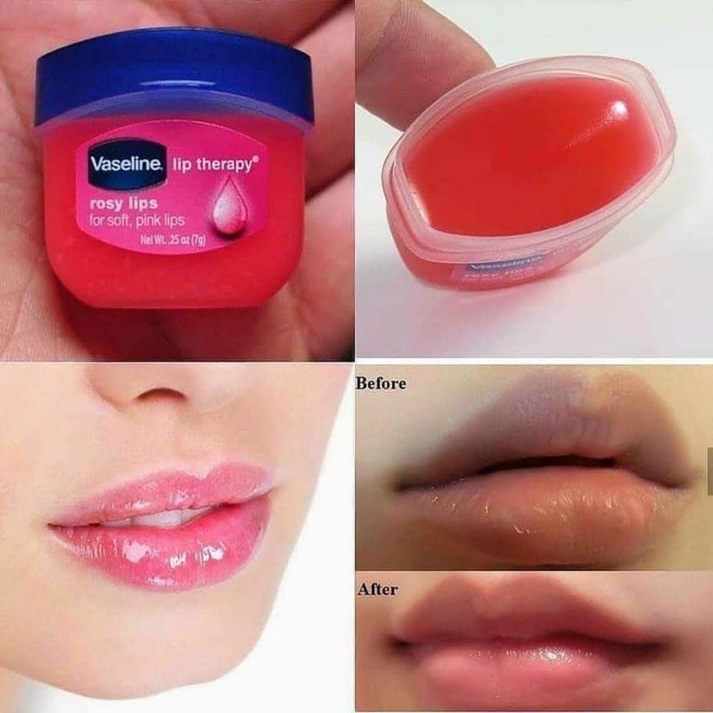 {Cam kết chính hãng} Dưỡng môi Vaseline Lip Therapy Rosy 7g Mỹ