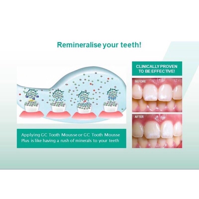 Gel Bôi Giảm Ê Buốt GC Tooth Mousse vị bạc hà - dâu