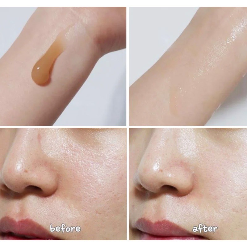 Kem dưỡng ẩm tinh chất rau má Madagascar Centella Cream Skin 1004