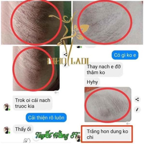 BIHO LADI Siêu Dưỡng Thâm 5s  [XÓA THÂM NÁCH, BỤNG Bẹn, Cùi Trỏ ] | BigBuy360 - bigbuy360.vn