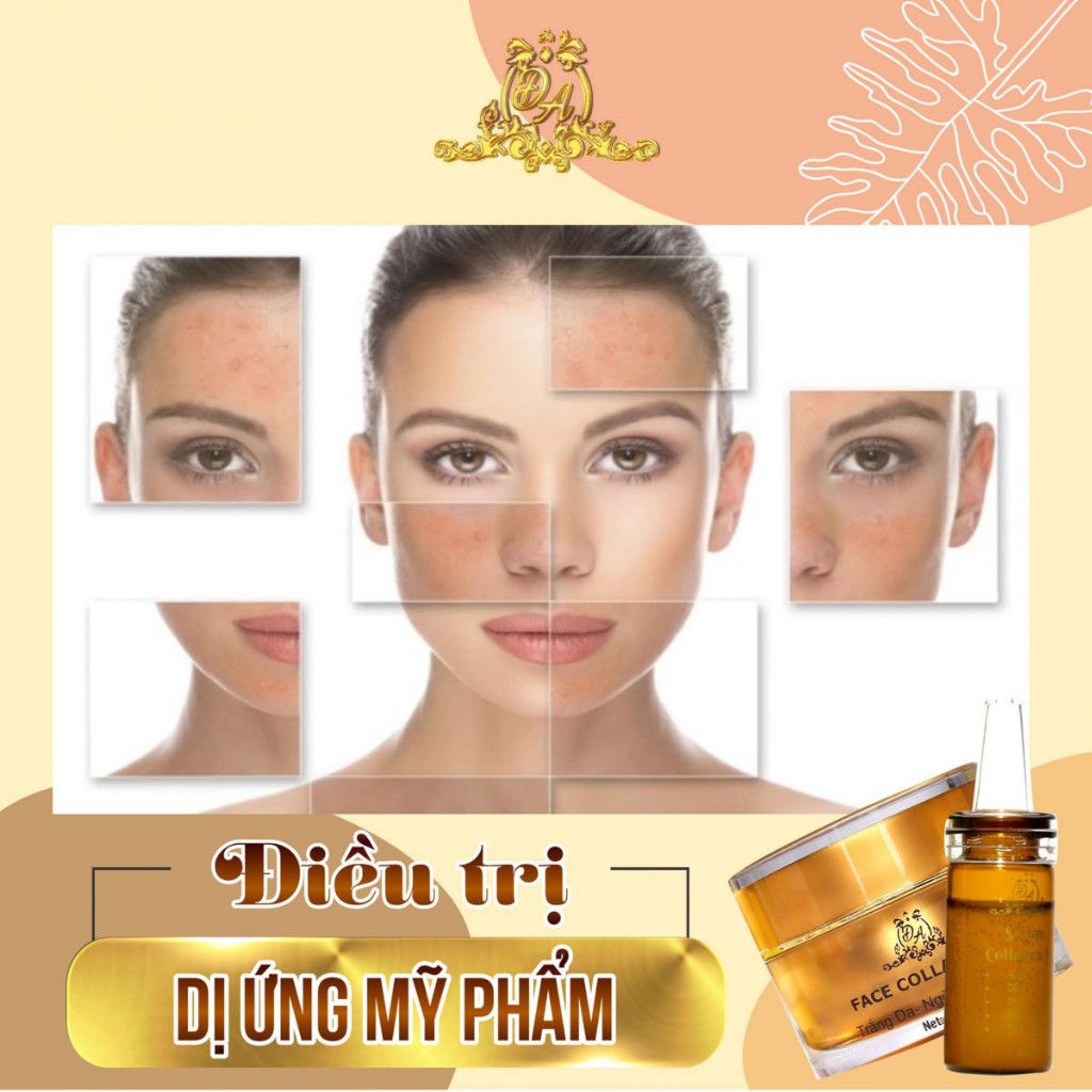 Kem Face Collagen X3 Trắng Da Ngừa Nám Mụn Se Khít Lỗ Chân Lông