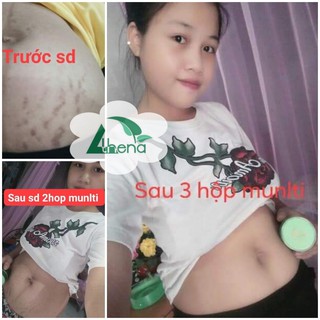 Kem Đa Năng Multi 16 Athena 30g
