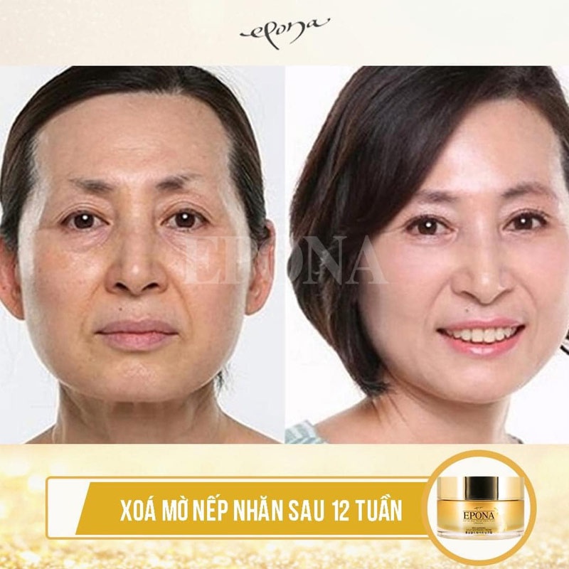 [Vàng] Kem dưỡng xóa mờ thâm nám nếp nhăn chiết xuất hồng sâm EPONA Red Ginseng GOLD 50ml