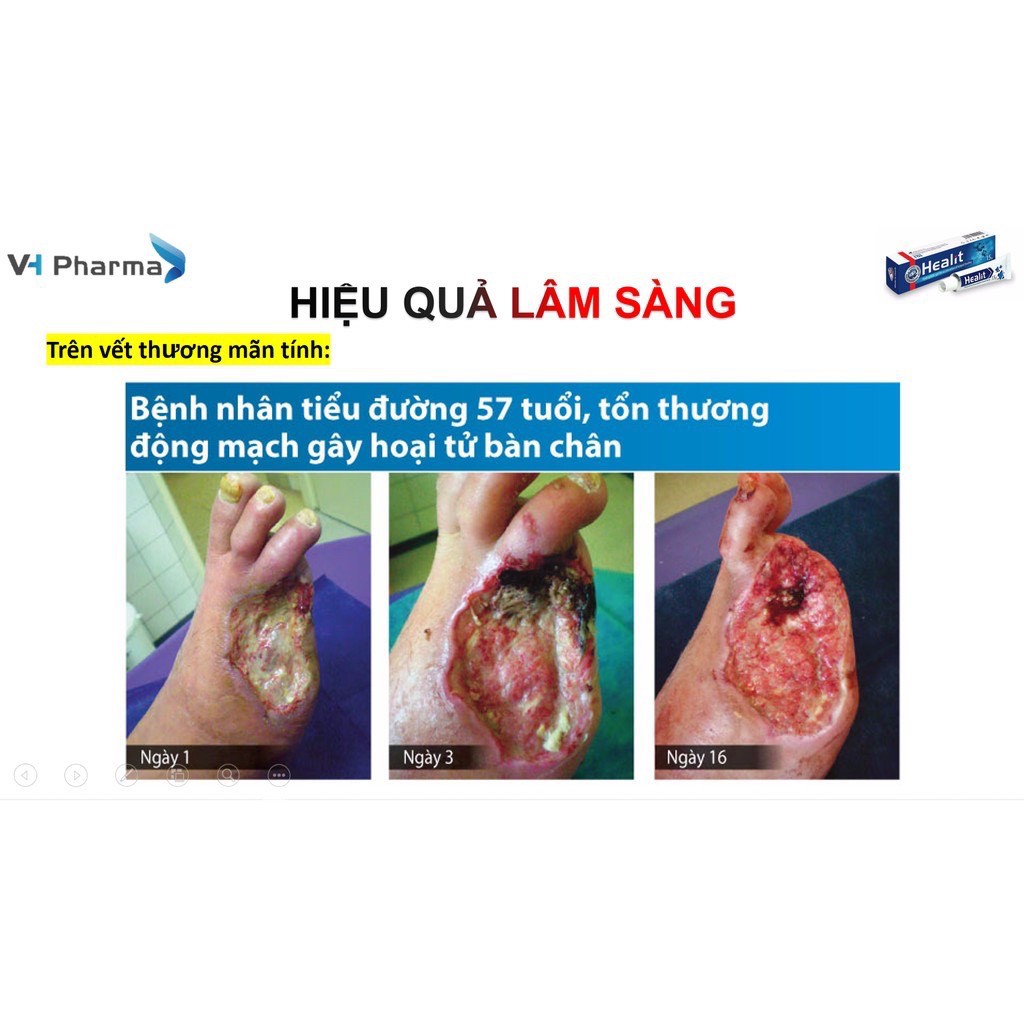 HEALIT GEL - Gel Bôi Vết Thương Hở Healit, Vết Bỏng, Loét do Tỳ đè, Nứt kẽ hậu môn, Trĩ - Cộng hòa Séc