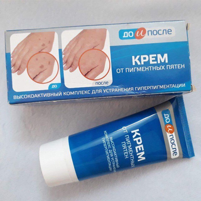Kem đồi mồi tay chân Kpem Nga - Kem giảm đồi mồi tay chân KPEM