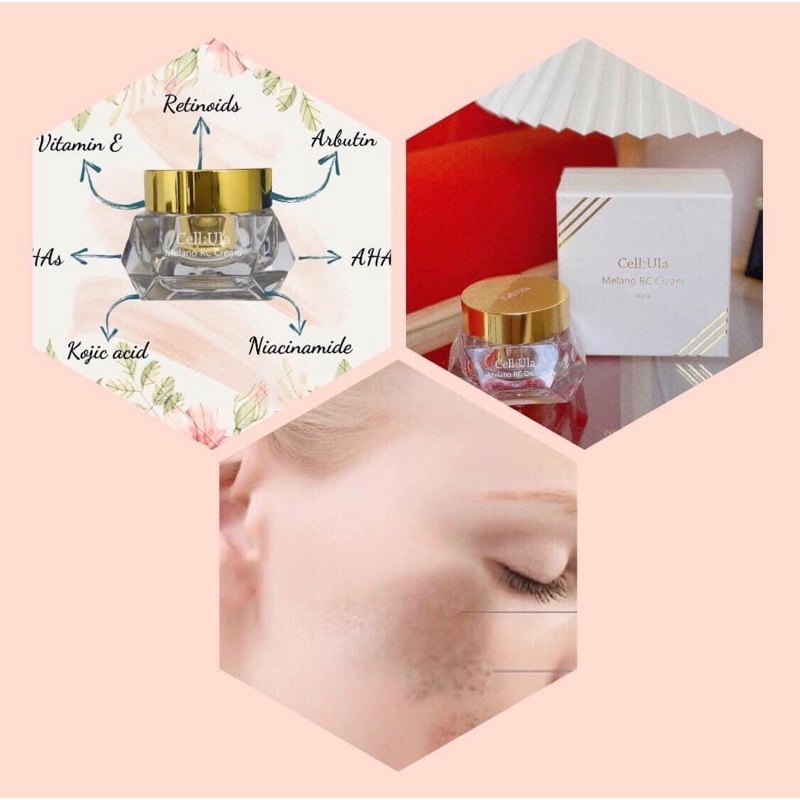 KEM PEEL DA HUỶ NÁM MELANO RC CREAM CELLula