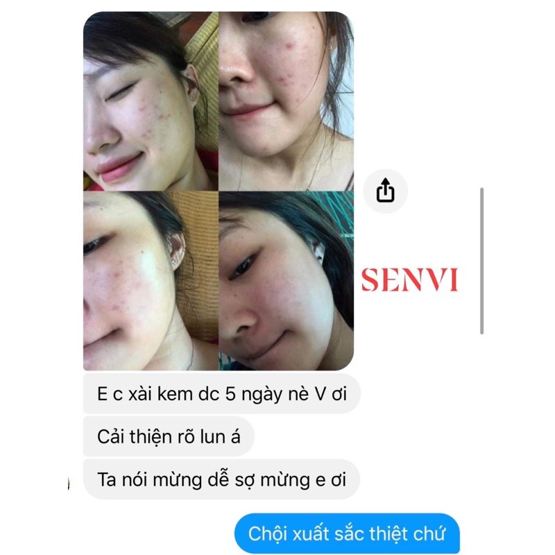 Serum mụn SENVI