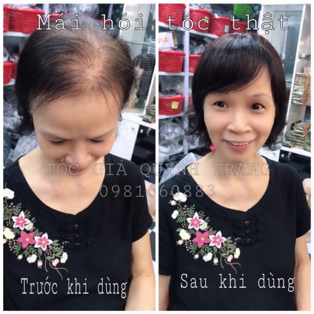 Siêu phẩm mái che hói, Che tóc bạc (tóc thật 100% uốn nhuộm ép)